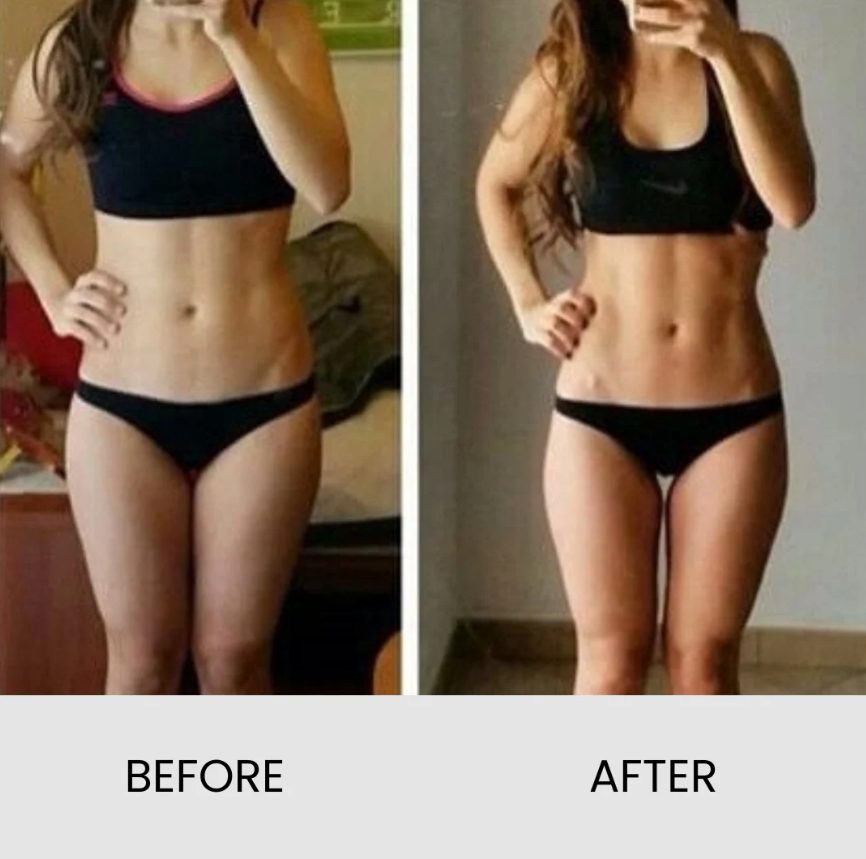 EMShape Neo+ Before & After 1