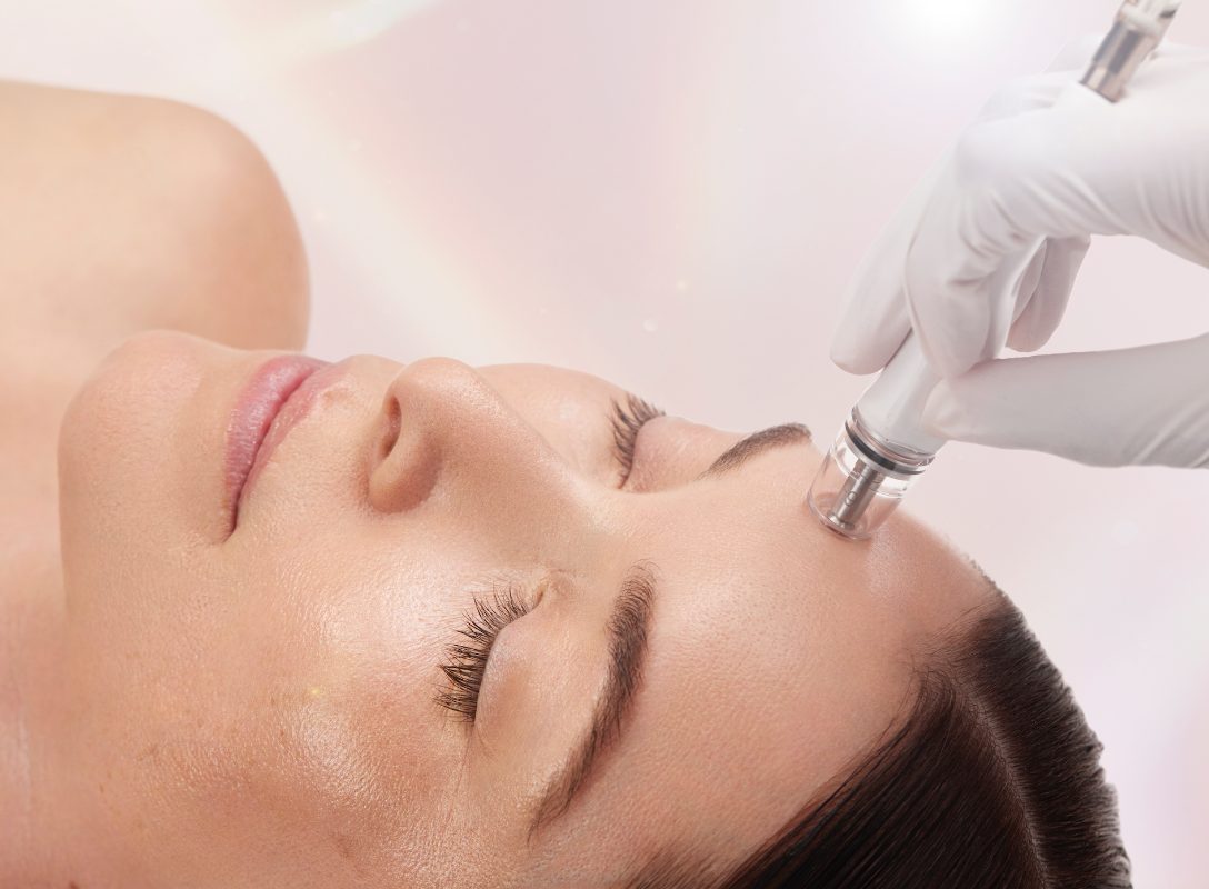 DiamondGlow Facial Package – Buy 3 Get 1 Free